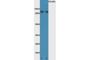 Lane 1:mouse brain lysate probed with Rabbit Anti-BMP1 Polyclonal Antibody, Unconjugated (ABIN873233) at 1:300 overnight at 4 °C. (BMP1 抗体)