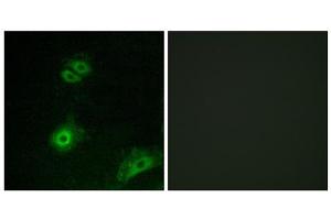 Immunofluorescence analysis of A549 cells, using OR4A16 antibody. (OR4A16 抗体  (C-Term))