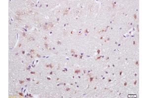 Formalin-fixed and paraffin embedded rat brain labeled with Rabbit Anti-NOX2/gp91phox Polyclonal Antibody, Unconjugated  at 1:200 followed by conjugation to the secondary antibody and DAB staining (CYBB 抗体  (AA 501-570))