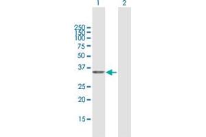Western Blot analysis of PDXK expression in transfected 293T cell line by PDXK MaxPab polyclonal antibody. (PDXK 抗体  (AA 1-312))