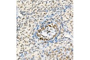 Immunohistochemistry of paraffin embedded rat ovary using Skar (ABIN7074970) at dilution of 1:900 (400x lens) (p46 抗体)