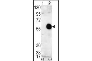 Western blot analysis of AKT2 (arrow) using AKT2 Antibody (C-term) (ABIN391022 and ABIN2841192). (AKT2 抗体  (C-Term))