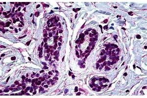 Immunohistochemistry (Formalin-fixed Paraffin-embedded Sections) (IHC (fp)) image for anti-Runt-Related Transcription Factor 1 (RUNX1) (AA 210-311) antibody (ABIN626025)