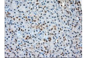 Immunohistochemical staining of paraffin-embedded Human Kidney tissue using anti-PFN1 mouse monoclonal antibody. (PFN1 抗体)