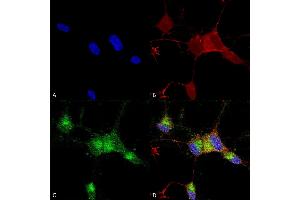Immunocytochemistry (ICC) image for anti-Sodium Channel, Voltage-Gated, Type IX, alpha Subunit (SCN9A) (AA 1751-1946) antibody (FITC) (ABIN2483098)