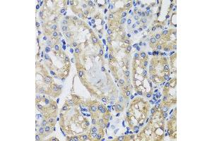 Immunohistochemistry of paraffin-embedded mouse kidney using MRPS22 antibody at dilution of 1:100 (x40 lens). (MRPS22 抗体)