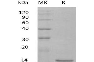 Western Blotting (WB) image for Interleukin 10 (IL10) protein (ABIN7320571) (IL-10 蛋白)