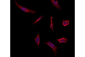 ABIN6263141 and ABIN6273054 staining Hela by IF/ICC.