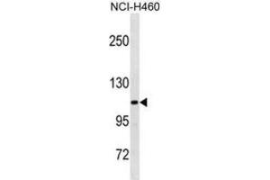 Western Blotting (WB) image for anti-Thrombospondin 4 (THBS4) antibody (ABIN3001104) (THBS4 抗体)