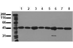 Western Blotting (WB) image for anti-Mitogen-Activated Protein Kinase Kinase 2 (MAP2K2) antibody (ABIN126838) (MEK2 抗体)