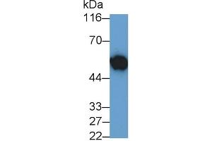 Detection of MYC in HL60 cell lysate using Polyclonal Antibody to V-Myc Myelocytomatosis Viral Oncogene Homolog (MYC) (LMYC 抗体  (AA 186-439))