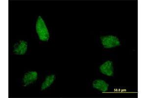 Immunofluorescence of purified MaxPab antibody to BANP on HeLa cell. (BANP 抗体  (AA 1-469))
