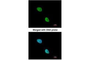 ICC/IF Image Immunofluorescence analysis of paraformaldehyde-fixed HeLa, using NKX2-5, antibody at 1:200 dilution. (NK2 Homeobox 5 抗体)