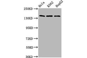 Western Blot Positive WB detected in: Hela whole cell lysate, K562 whole cell lysate, HepG2 whole cell lysate All lanes: SF3B1 antibody at 9. (SF3B1 抗体  (AA 186-378))