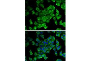 Immunofluorescence analysis of MCF7 cells using PPL antibody (ABIN6128532, ABIN6146036, ABIN6146038 and ABIN6222699). (PPL 抗体  (AA 1-130))