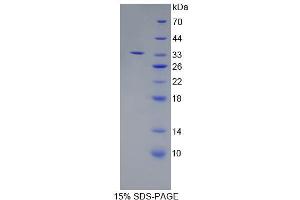 Image no. 1 for Endoplasmic Reticulum Aminopeptidase 2 (ERAP2) (AA 41-271) protein (His tag) (ABIN6237489)