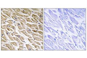 Immunohistochemistry (IHC) image for anti-Mitochondrial Ribosomal Protein L39 (MRPL39) (C-Term) antibody (ABIN1851576) (MRPL39 抗体  (C-Term))