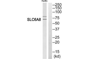 Western blot analysis of extracts from HuvEc cells, using SLC6A8 antibody. (SLC6A8 抗体  (C-Term))