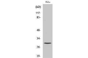 Western Blotting (WB) image for anti-Cathepsin L1 (CTSL1) (Cleaved-Thr288), (Heavy Chain) antibody (ABIN3181794) (Cathepsin L 抗体  (Cleaved-Thr288, Heavy Chain))