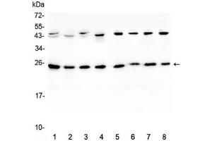 Western blot testing of 1) rat brain, 2) rat lung, 3) mouse brain, 4) mouse lung and human 5) HeLa, 6) placenta, 7) MCF7 and 8) HepG2 lystate with IL36A antibody at 0. (IL36A/IL1F6 抗体  (AA 6-151))
