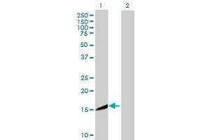 Western Blot analysis of CRYZL1 expression in transfected 293T cell line by CRYZL1 MaxPab polyclonal antibody. (CRYZL1 抗体  (AA 1-113))