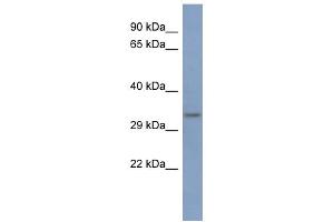 WB Suggested Anti-PCBP3 Antibody Titration:  0. (PCBP3 抗体  (Middle Region))