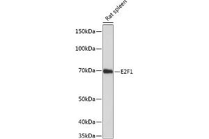 Western blot analysis of extracts of rat spleen, using E2F1 antibody (ABIN7266873) at 1:1000 dilution. (E2F1 抗体)
