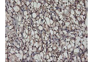 Image no. 2 for anti-V-Akt Murine Thymoma Viral Oncogene Homolog 1 (AKT1) antibody (ABIN1496554) (AKT1 抗体)
