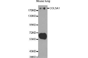 Western blot analysis of extracts of mouse lung, using COL5A1 antibody (ABIN5970709) at 1/500 dilution. (COL5A1 抗体)