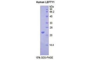 SDS-PAGE (SDS) image for Left-Right Determination Factor 1 (LEFTY1) (AA 167-332) protein (His tag) (ABIN1877875)