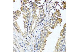 Immunohistochemistry of paraffin-embedded human prostate using STK3 antibody at dilution of 1:100 (x40 lens). (STK3 抗体)
