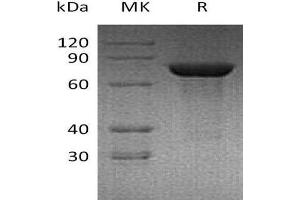 Western Blotting (WB) image for Transglutaminase 2 (C Polypeptide, Protein-Glutamine-gamma-Glutamyltransferase) (TGM2) protein (His tag) (ABIN7320672)