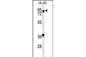 Western blot analysis of TL1 Antibody (C-term) (ABIN653753 and ABIN2843053) in HL-60 cell line lysates (35 μg/lane). (PATL1 抗体  (C-Term))