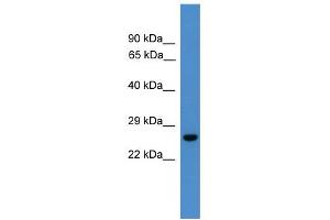 WB Suggested Anti-UCHL3 Antibody Titration: 0. (UCHL3 抗体  (C-Term))