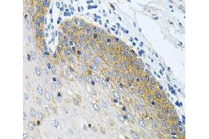 Immunohistochemistry of paraffin-embedded Human esophagus using GNE Polyclonal Antibody at dilution of 1:100 (40x lens). (GNE 抗体)