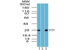 Image no. 1 for anti-Interleukin 1 Receptor-Like 1 (IL1RL1) (AA 207-220) antibody (ABIN960225)