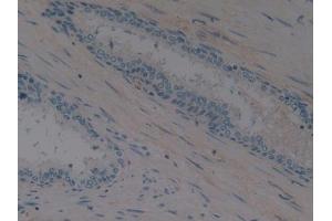 Detection of EPO in Human Prostate Tissue using Polyclonal Antibody to Erythropoietin (EPO) (EPO 抗体  (AA 28-193))