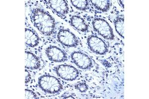 Immunohistochemistry of paraffin-embedded human colon using CDC40 Rabbit mAb (ABIN7266255) at dilution of 1:100 (40x lens). (CDC40 抗体)