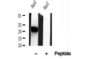 Western blot analysis of extracts of HepG2 cells, using Tim23 antibody. (TIMM23 抗体  (N-Term))