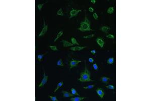 Immunofluorescence analysis of L-929 cells using Oncostatin M antibody (ABIN6128404, ABIN6145072, ABIN6145073 and ABIN6221768) at dilution of 1:100. (Oncostatin M 抗体  (AA 26-252))