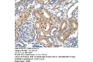 Immunohistochemistry (IHC) image for anti-Solute Carrier Family 39 (Zinc Transporter), Member 6 (SLC39A6) (Middle Region) antibody (ABIN2781630)