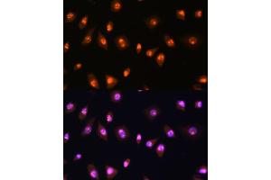 Immunofluorescence (IF) image for anti-Ly1 Antibody Reactive (LYAR) (AA 10-160) antibody (ABIN7268311)