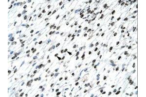 Image no. 3 for anti-Homeobox B9 (HOXB9) (AA 67-116) antibody (ABIN6735813) (HOXB9 抗体  (AA 67-116))