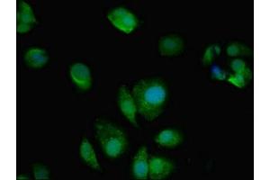 Immunofluorescent analysis of MCF-7 cells using ABIN7144021 at dilution of 1:100 and Alexa Fluor 488-congugated AffiniPure Goat Anti-Rabbit IgG(H+L) (AMPD2 抗体  (AA 1-129))