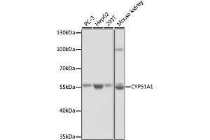 Western blot analysis of extracts of various cell lines, using CYP51 antibody (3485) at 1:1000 dilution. (CYP51A1 抗体  (AA 210-509))