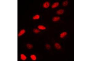 Immunofluorescent analysis of NCOR1 staining in HeLa cells. (NCOR1 抗体  (N-Term))