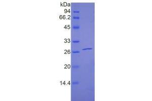 SDS-PAGE of Protein Standard from the Kit (Highly purified E. (PAPPA2 ELISA 试剂盒)