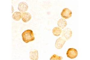 Immunocytochemistry staining of HeLa cells using CFLAR polyclonal antibody  at 2 ug/mL . (FLIP 抗体  (AA 191-209))