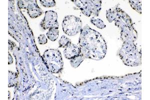 Immunohistochemistry (IHC) image for anti-Mediator Complex Subunit 15 (MED15) (AA 1-285) antibody (ABIN5519035)
