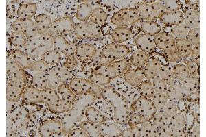 ABIN6277648 at 1/100 staining Rat kidney tissue by IHC-P. (CRYbB2 抗体  (Internal Region))